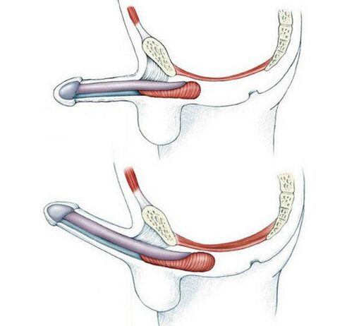 Penis without training the pubococcygeus muscle and after