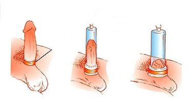 The principle of operation of the pump to increase the penis