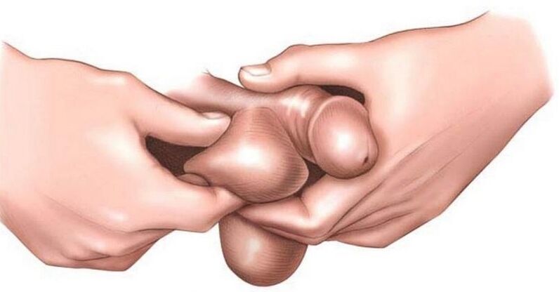 Why are eggs itching in men